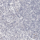 Immunohistochemical staining of human lymph node shows low expression as expected.