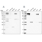Western blot analysis using Anti-CGN antibody HPA027586 (A) shows similar pattern to independent antibody HPA027657 (B).