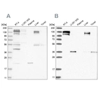 Western blot analysis using Anti-CGN antibody HPA027586 (A) shows similar pattern to independent antibody HPA027657 (B).