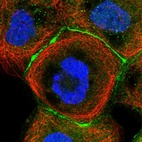 Immunofluorescent staining of human cell line A-431 shows localization to plasma membrane & cell junctions.