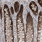 Immunohistochemical staining of human Rectum shows strong membranous and cytoplasmic positivity in glandular cells.