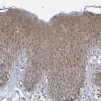 Immunohistochemical staining of human Skin shows moderate cytoplasmic positivity in squamous epithelial cells.