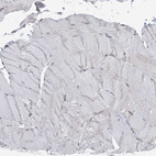 Immunohistochemical staining of human Skeletal muscle shows very weak membranous positivity in myocytes.