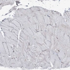 Immunohistochemical staining of human Skeletal muscle shows very weak membranous positivity in myocytes.