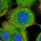 Immunofluorescent staining of human cell line A-431 shows localization to plasma membrane & cytosol.