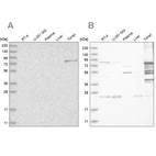 Western blot analysis using Anti-PKP1 antibody HPA027589 (A) shows similar pattern to independent antibody HPA027221 (B).