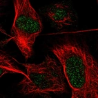 Immunofluorescent staining of human cell line U-2 OS shows localization to nucleoplasm.