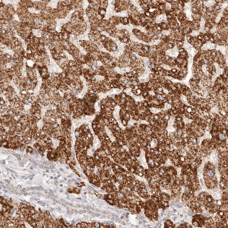 Anti-IL1R2 Antibody