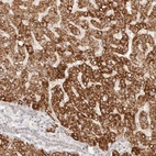 Anti-IL1R2 Antibody