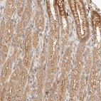 Immunohistochemical staining of human stomach shows moderate positivity in apical membrane in glandular cells.