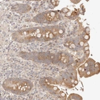 Anti-PHLDA3 Antibody