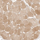 Immunohistochemical staining of human skeletal muscle shows moderate cytoplasmic positivity in myocytes.