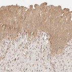 Immunohistochemical staining of human urinary bladder shows moderate cytoplasmic positivity in urothelial cells.