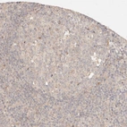 Immunohistochemical staining of human tonsil shows very weak positivity in germinal center cells as expected.