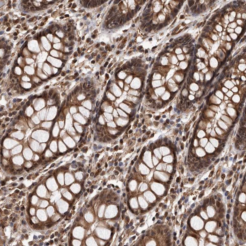 Anti-ADAMTS20 Antibody