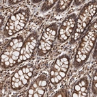 Anti-ADAMTS20 Antibody