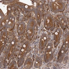 Anti-ADAMTS20 Antibody