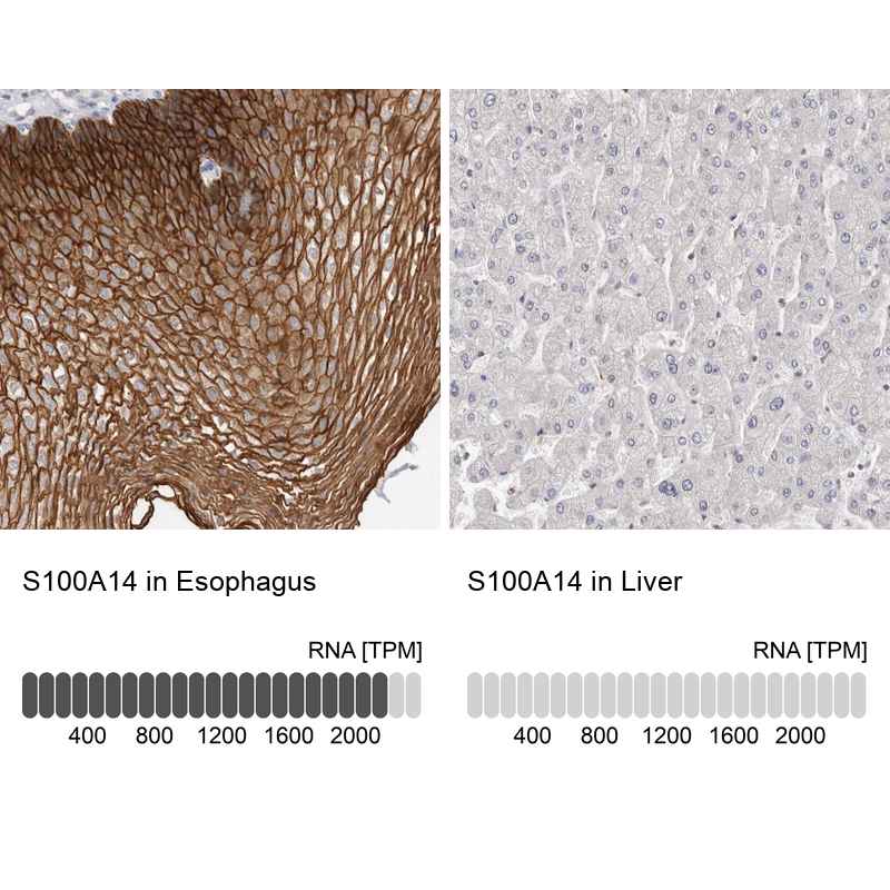 Anti-S100A14 Antibody