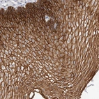 Immunohistochemical staining of human esophagus shows strong membranous positivity in squamous epithelial cells.