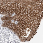 Immunohistochemical staining of human skin shows strong membranous positivity in squamous epithelial cells.