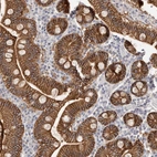 Immunohistochemical staining of human duodenum shows moderate membranous positivity in glandular cells.