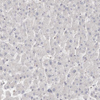 Anti-S100A14 Antibody