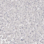 Immunohistochemical staining of human liver shows no positivity in hepatocytes as expected.