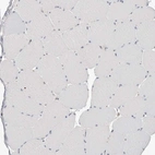 Immunohistochemical staining of human skeletal muscle shows no positivity in myocytes as expected.
