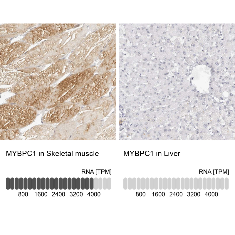 Anti-MYBPC1 Antibody