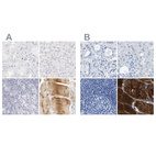 Immunohistochemical staining of human kidney, liver, lymph node and skeletal muscle using Anti-MYBPC1 antibody HPA027614 (A) shows similar protein distribution across tissues to independent antibody HPA021004 (B).