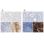 Immunohistochemical staining of human kidney, liver, lymph node and skeletal muscle using Anti-MYBPC1 antibody HPA027614 (A) shows similar protein distribution across tissues to independent antibody HPA021004 (B).