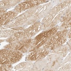 Immunohistochemical staining of human skeletal muscle shows high expression.