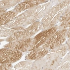 Immunohistochemical staining of human skeletal muscle shows high expression.