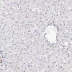 Anti-MYBPC1 Antibody