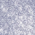 Immunohistochemical staining of human lymph node using Anti-MYBPC1 antibody HPA027614.