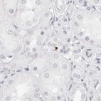 Immunohistochemical staining of human kidney using Anti-MYBPC1 antibody HPA027614.