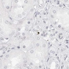 Immunohistochemical staining of human kidney using Anti-MYBPC1 antibody HPA027614.