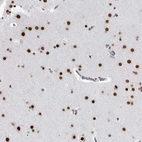 Anti-RNF26 Antibody