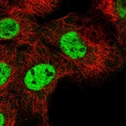 Immunofluorescent staining of human cell line A-431 shows localization to nucleoplasm.