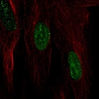 Immunofluorescent staining of human cell line BJ shows localization to nucleoplasm.