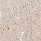 Anti-MRPL55 Antibody