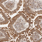 Immunohistochemical staining of human small intestine shows moderate granular cytoplasmic positivity in glandular cells.