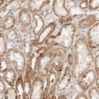 Immunohistochemical staining of human kidney shows moderate to strong granular cytoplasmic positivity in cells in tubules.