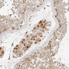 Immunohistochemical staining of human testis shows moderate granular cytoplasmic positivity in Leydig cells.