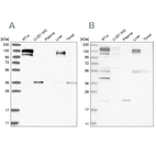 Western blot analysis using Anti-CGN antibody HPA027657 (A) shows similar pattern to independent antibody HPA027586 (B).