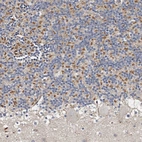 Anti-KIF26B Antibody