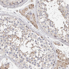 Immunohistochemical staining of human testis shows weak cytoplasmic positivity in Leydig cells.