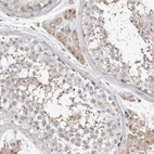 Immunohistochemical staining of human testis shows weak cytoplasmic positivity in Leydig cells.