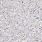 Immunohistochemical staining of human liver shows no positivity in hepatocytes as expected.