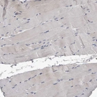 Immunohistochemical staining of human skeletal muscle shows no positivity in myocytes as expected.